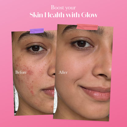 Japanese Glutathione & Vit. C for skin radiance & even tone - Strawberry & Lemon - Pack of 1